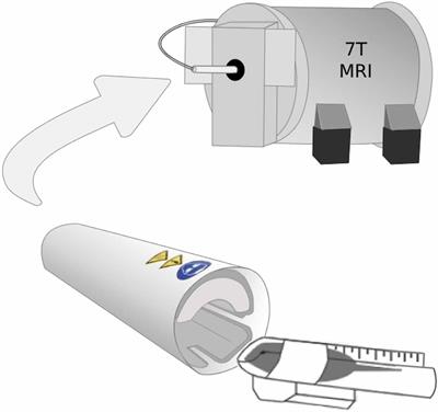 GABA Measurement in a Neonatal Fragile X Syndrome Mouse Model Using 1H-Magnetic Resonance Spectroscopy and Mass Spectrometry